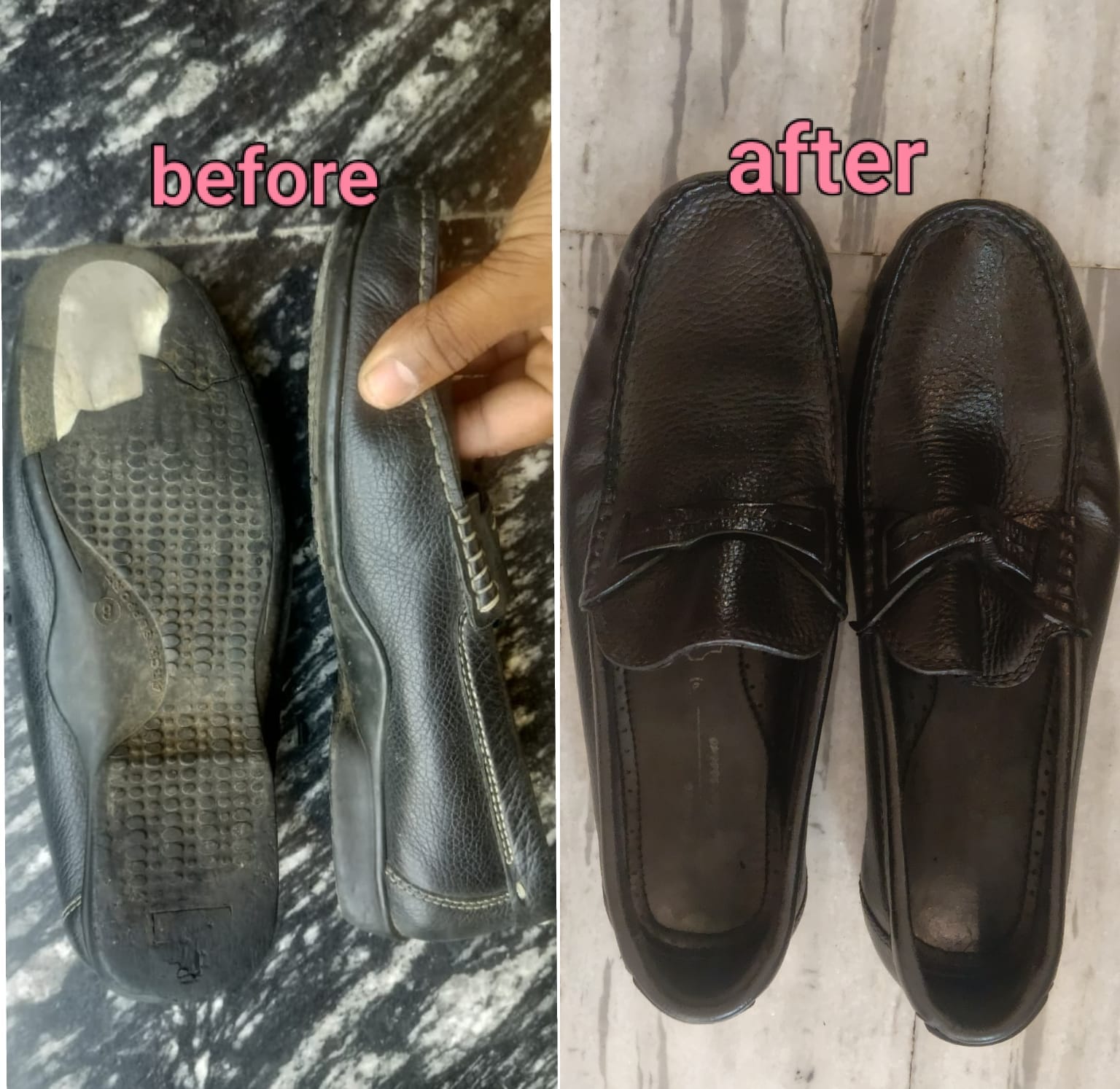 Sole brightening before and after result